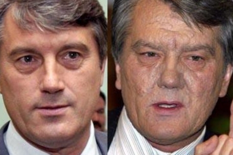 Украинцам навязывали версию умышленного отравления Ющенко