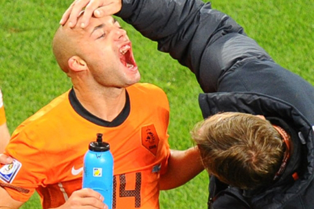 Голландский полузащитник лишился в полуфинале ЧМ зуба