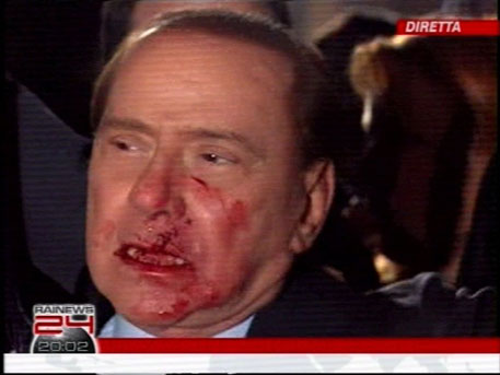 Сильвио Берлускони не выписали из больницы