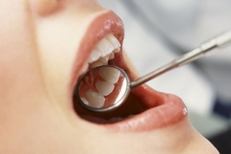 В Казахстане закрыли 44 стоматологии из-за нарушения санитарных норм 