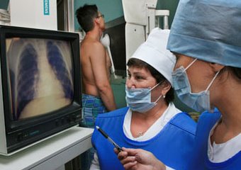 Казахстан вошел в список лидеров по числу больных туберкулезом