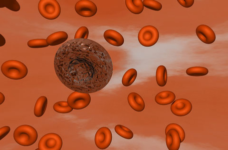 Ученые разгадали секрет образования кровяных тромбов