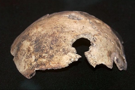 Найденный череп Гитлера принадлежал женщине