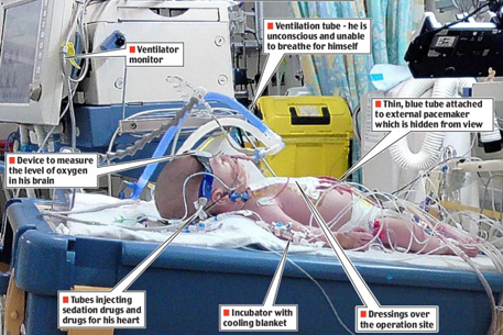 Британские врачи "заморозили" младенца на четыре дня