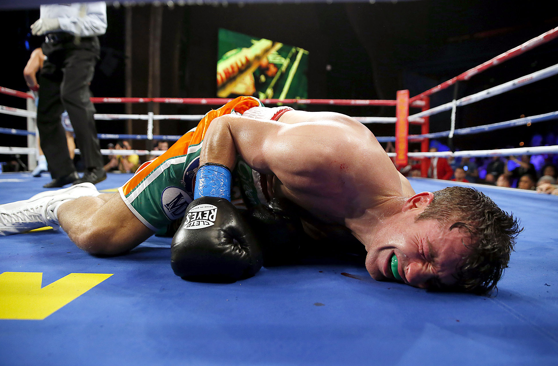 Боксер после удара в затылок инвалид. Gennady Golovkin – Matthew Macklin.