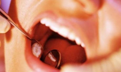 В Туле представившаяся врачом уборщица вырвала ребенку здоровый зуб