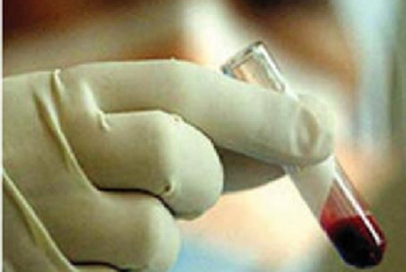 В Экибастузе число зараженных гепатитом детей достигло 19
