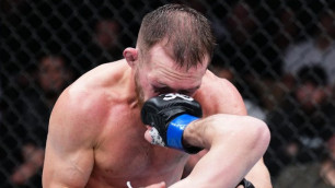 Побитое лицо Петра Яна после разгромного поражения в UFC. Фото