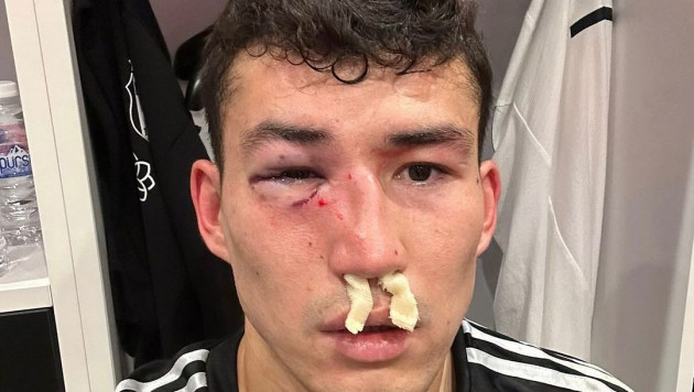 "Бешикташ" опубликовал фото Зайнутдинова после травмы в матче с "Истанбулом"