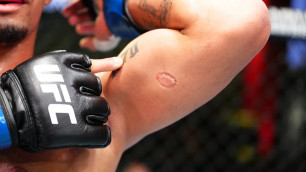Уволенный из UFC за укус боец получил еще одну неприятную новость