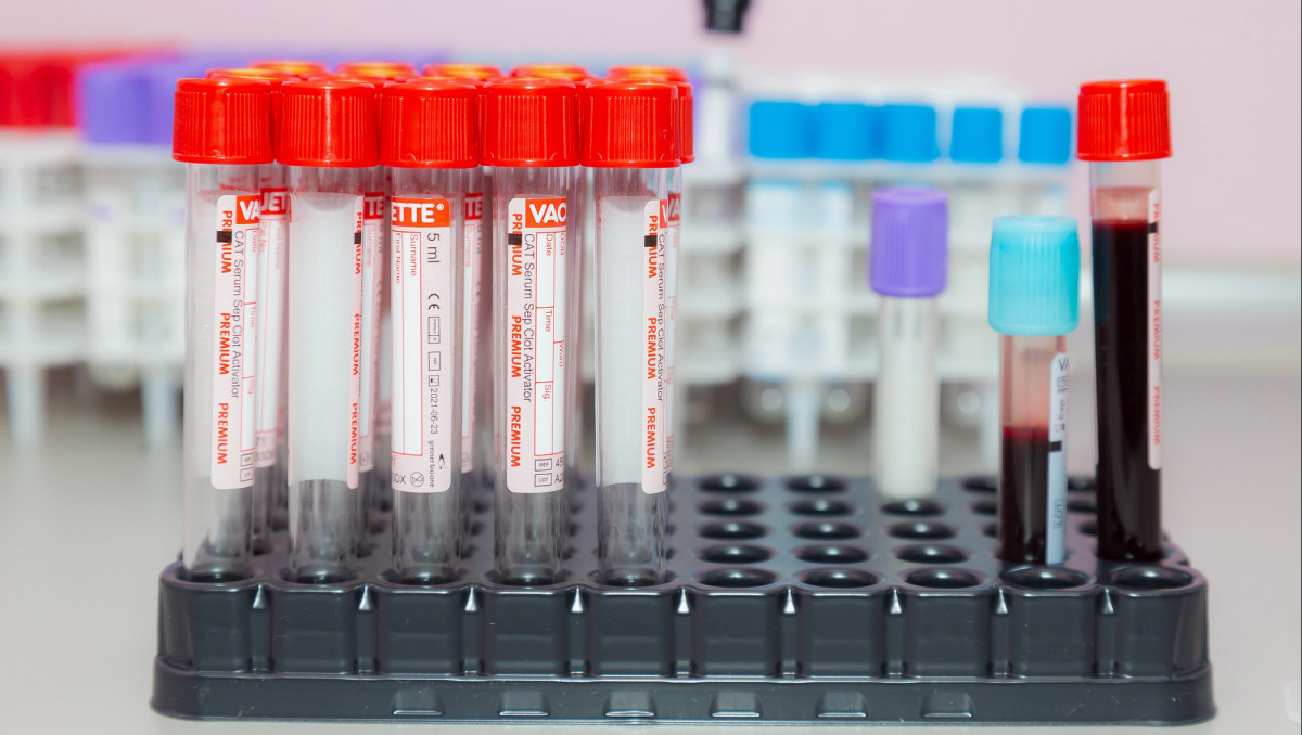 Первый скандал перед ОИ-2026: обнаружена положительная допинг-проба