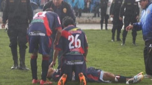 Перуанский футболист выжил после попадания молнии во время матча