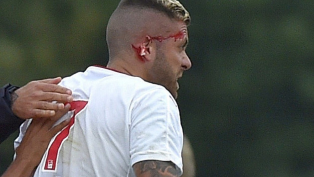 Жереми Менез потерял часть уха в дебютном матче за "Бордо"