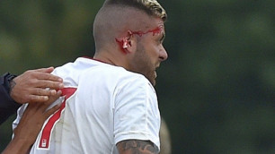 Жереми Менез потерял часть уха в дебютном матче за "Бордо"