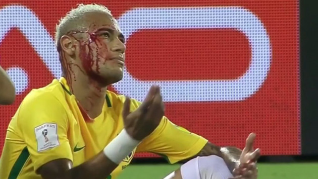 Неймару разбили лицо в матче сборной Бразилии