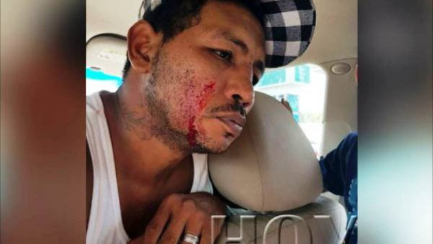 Экс-чемпиону мира по боксу Рикардо Майорге разбили лицо на автозаправке в Никарагуа