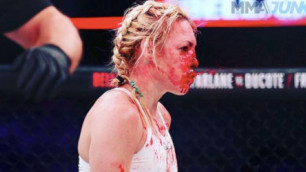 "Два фингала, девять швов и сломанный нос". Девушка-боксер показала свое лицо после кровавого боя в MMA