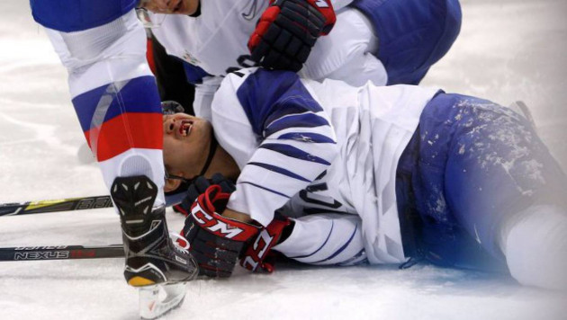 Южнокорейский хоккеист получил клюшкой по лицу и лишился трех зубов в матче с Канадой на ОИ-2018