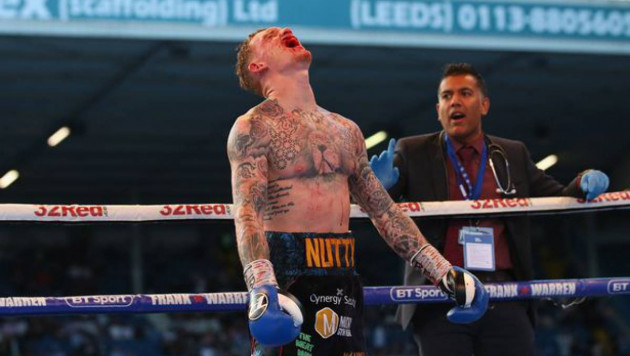 Британскому боксеру порвали губу в титульном бою и нанесли первое поражение в карьере