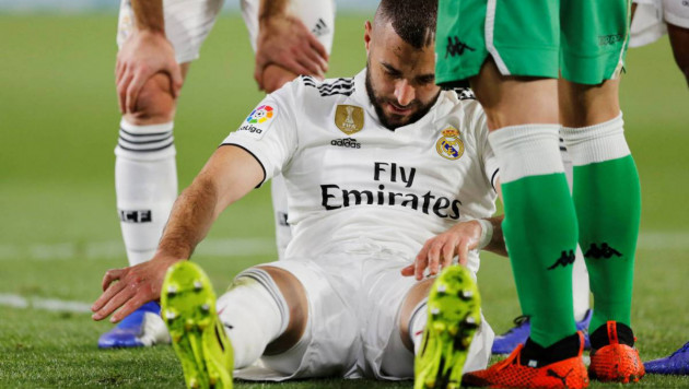 Футболист "Реала" сломал мизинец и напугал одноклубника