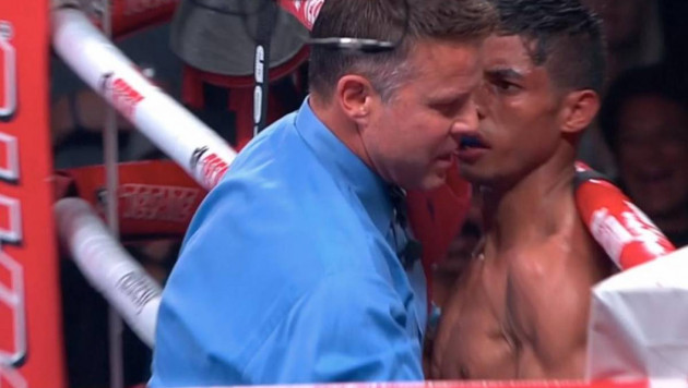 Чемпион мира по версии WBO сенсационно проиграл малоизвестному мексиканцу