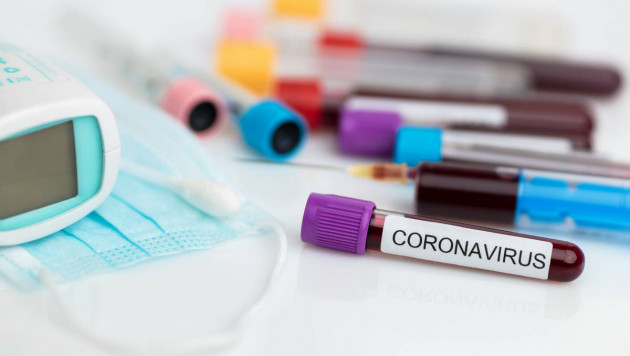 14 новых случаев коронавируса выявили в Нур-Султане