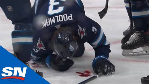 Игрок НХЛ заблокировал шайбу лицом и залил лед кровью