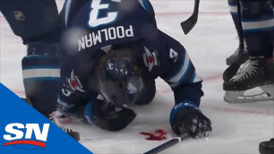 Игрок НХЛ заблокировал шайбу лицом и залил лед кровью
