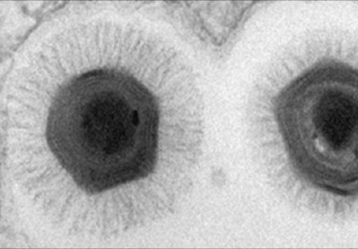 Снимок самого большого в мире вируса Megavirus. Фото с сайта bbc.co.uk