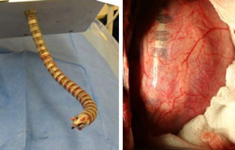Змея-робот проведет операцию на человеческом сердце