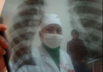В школе Китая 170 человек заразились туберкулезом