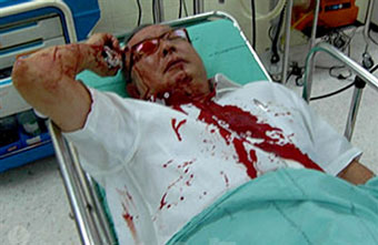Пуля в голове не убила тайского оппозиционера